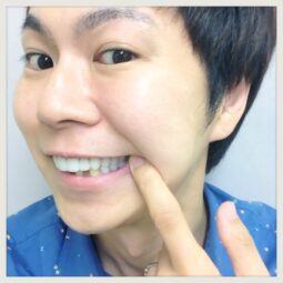 【朗報】保険適用の白い歯(CAD/CAM冠)箇所条件変更！東京/銀歯/歯科