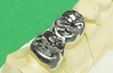 白くて強い歯を『保険適応』で安く手に入れる方法（CAD/CAM）
