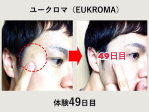 【体験49日目】シミ消しクリーム『ユークロマ（EUKROMA）』口コミ-00
