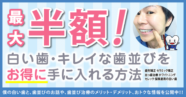 【最大50%OFF】白い歯・キレイな歯並びをお得に手に入れる方法-東京