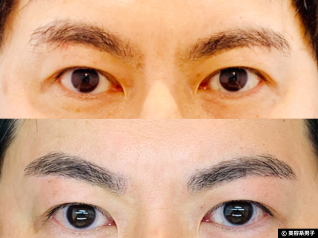 【恵比寿】第一印象を変える「メンズ眉毛サロンラボ」体験レポート-10