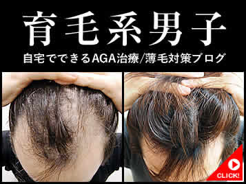 【お知らせ】自宅でできるAGA治療/セルフケアBLOG「育毛系男子」開設