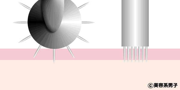 【美肌】ダーマペン簡易版セルフ「電動ダーマスタンプ」違いと効果-07