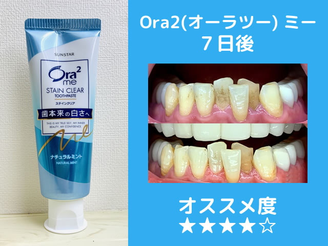 【保存版】市販ホワイトニング歯磨き粉おすすめランキング-効果-01