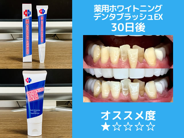 【保存版】市販ホワイトニング歯磨き粉おすすめランキング-効果-03