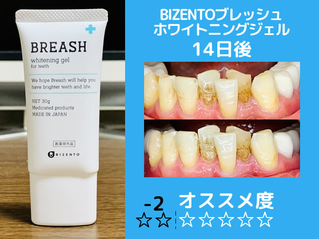 【保存版】市販ホワイトニング歯磨き粉おすすめランキング-効果-06
