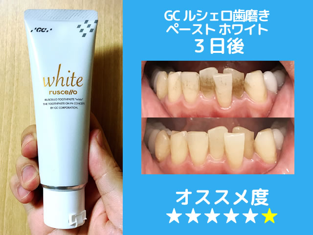 【保存版】市販ホワイトニング歯磨き粉おすすめランキング-効果-09