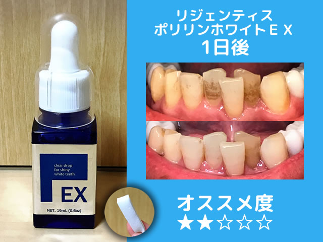 【保存版】市販ホワイトニング歯磨き粉おすすめランキング-効果-12