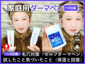 【～4日後】毛穴対策「セルフダーマペン」試したこと気づいたこと-00