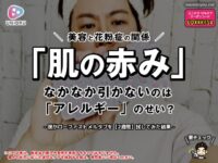 「肌の赤み」が引かないのはアレルギーのせい？ロラタジンを2週間試してみたリアルな結果