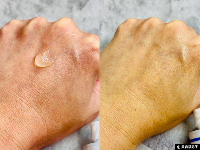 【乾燥肌】ヒルドイドに頼る前に行うスキンケア｜その原因と市販・処方・海外の効果の違い-04