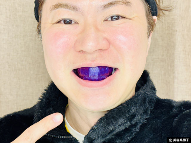 【TikTokで爆売れ】歯は白くなる？CEELIKE nHAP-PRO ホワイトニングストリップを検証-05