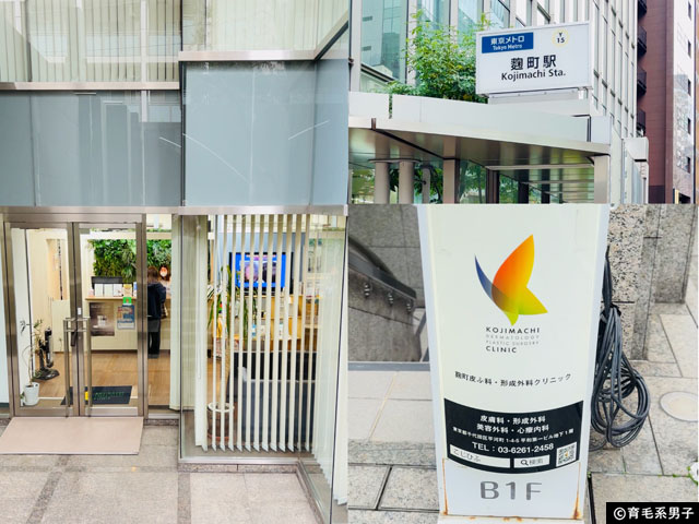 【体験レポ】切らない「たるみ」治療 HIFU（ハイフ）3種打ちしてきた｜麹町皮ふ科・形成外科クリニック-01