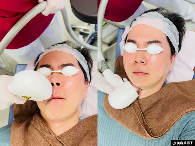 【ヒゲ脱毛・ムダ毛】医療脱毛がおすすめ!エステ脱毛・セルフ脱毛・家庭用との違いを徹底解説-01