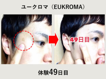 【体験49日目】シミ消しクリーム『ユークロマ（EUKROMA）』口コミ-00